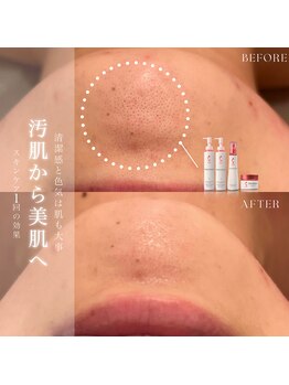 ヴィヴィアン 太田川店(Vivian)/根本から肌質改善！