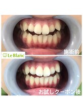 ルブラン 奈良店(Le Blanc)/お試しで満足する方も