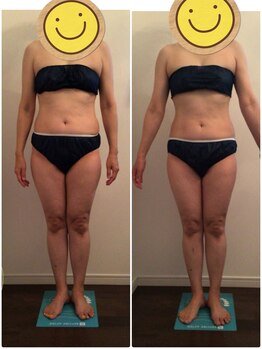 ビューティー サロン ハナ(Beauty Salon hana)/筋膜リリース5回の施術効果