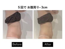 ナチュラーレ 梅田店(Naturale)/リンパマッサージ痩身ダイエット