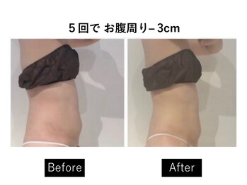ナチュラーレ 梅田店(Naturale)/リンパマッサージ痩身ダイエット