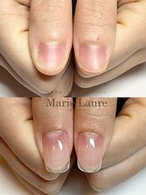 マリーロール 淀屋橋本店(Marie Laure)/自爪育成/深爪矯正/ネイルケア