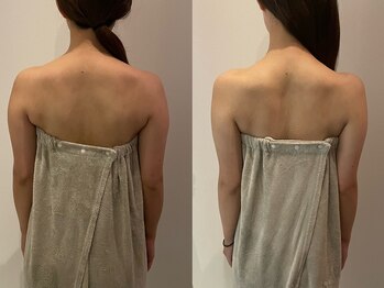 サロンリーナ 銀座店(SalonLena)/ブライダル(背中)