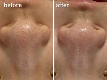 メルシア(merucia)/