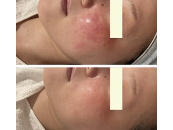 マラマ(Malama)/ビフォーアフター