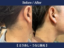 ランドマーク 中崎町(LANDMARK.)/《 襟足 》