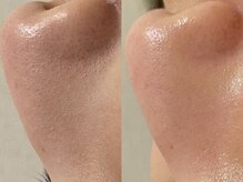 リスポアラボ(LIS PORE.LAB)/