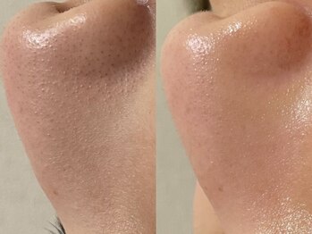 リスポアラボ(LIS PORE.LAB)/