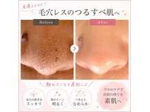 CPサロン 都立大店の雰囲気（毛穴の大掃除、小顔リフトマッサージでつるすべたまご肌）