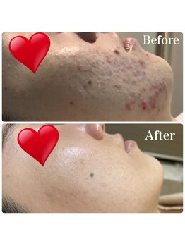 ジョアアンジェ 京橋店(joie ange)/劇的ビフォーアフター