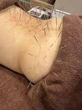 四条通り治療院/