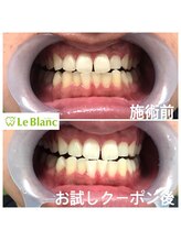 ルブラン 奈良店(Le Blanc)/ブライダル前のオススメメニュー