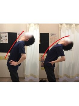 蕨整体院/骨盤矯正で柔軟性UP