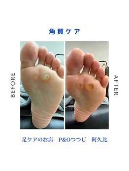 ピーアンドオー(P&O)/