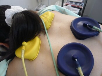 アタック鍼灸院(ATAC鍼灸院)/干渉波による筋緊張の緩和