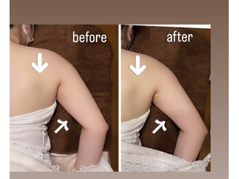 イヴ(Yves)/ハイパーナイフbefore/after