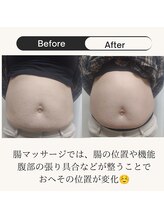 一呼休/下がった腸が元の位置へ