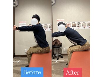 ナオル整体 宮崎院(NAORU整体)/40代男性施術事例【腰痛改善】