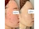 アミュレット(AMULET)の写真