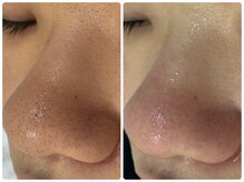 サイセイ(SAISEI)/