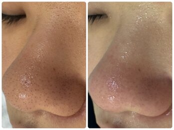 サイセイ(SAISEI)/