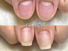 グラシナ 鳥丸店/(深爪/長さだし/フィルイン/)