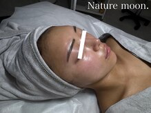 ナチュールムーン(Nature moon.)/ハーブピーリング after