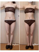 アンフィニ(infini)/短期集中コース5回目（1.5ヶ月）