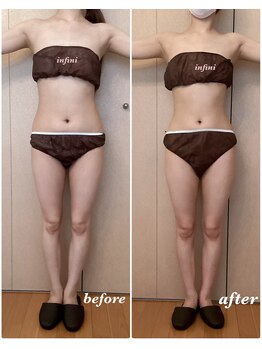 アンフィニ(infini)/短期集中コース5回目(1.5ヶ月)