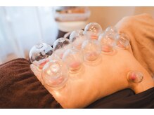 はり灸ソル(はり灸Sol)/吸玉