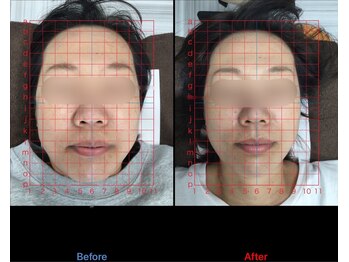 大久保ひまわり整骨院/~小顔矯正~