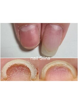 スゴ腕の施術者がいるサロン