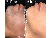 デール(R:DeeL)の雰囲気（メンズ脱毛大人気。男性スタッフ担当で彼女や奥様が勧めるサロン）