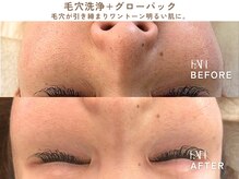 ファン(FAN)/グローパック BEFORE-AFTER