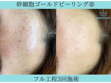 リメイククリニカルビューティー(Remake clinical beauty)/