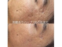 ベリスユイット(BELLIS HUIT)