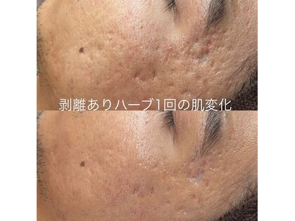 ベリスユイット(BELLIS HUIT)の写真