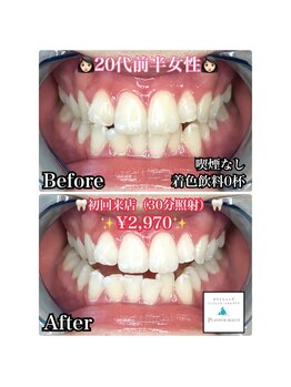 プラチナムビューティー 横須賀店/