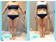 千歳の女神 岡崎店/【施術風景】Before/After