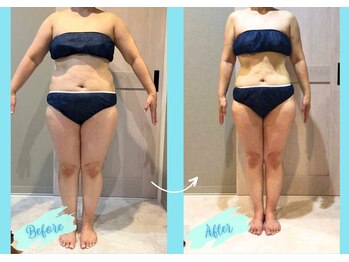 千歳の女神 岡崎店/【施術風景】Before/After