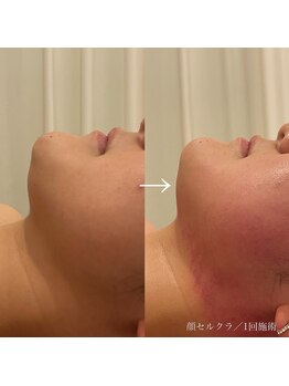 エクラ(eclat)/セルクラ