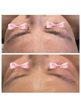 美温(mion)/肌質ふっくら