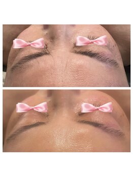 美温(mion)/肌質ふっくら