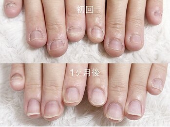 深爪矯正 爪悩み専門店 cocomo/(深爪/長さだし/フィルイン)