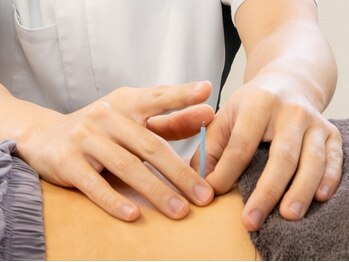 しのとう鍼灸整体院の写真/《国家資格保持者在籍！》専門知識に基づいた＜丁寧なカウンセリング×高技術＞でお悩みにアプローチ♪