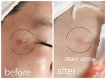 キレイラボ(Ki-Re-i LABO)