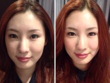 ルディア 堂島店(ledia)の雰囲気（大阪美容鍼/梅田美容鍼/北新地美容鍼/堂島美容鍼/福島美容鍼）