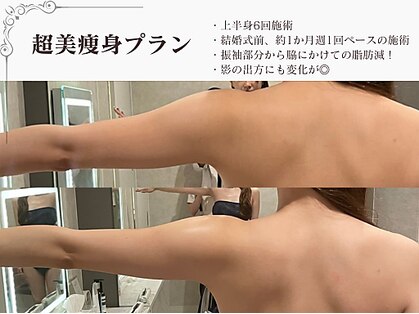 ラブミー 渋谷本店(LoveMe)の写真