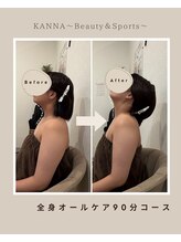 カンナ(KANNA)/30代　女性　施術例