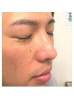 アイビー 神保町店(i.b)/【ノーズワックス】5